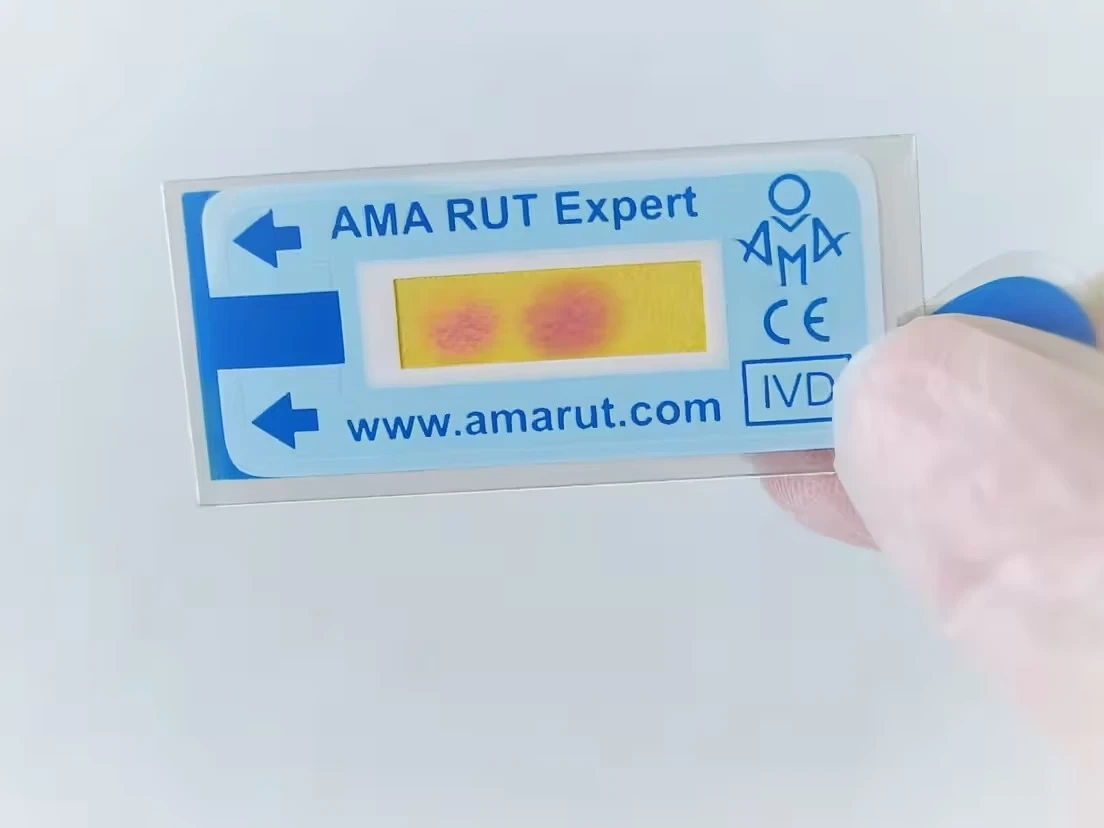 Test de ureasa Expert